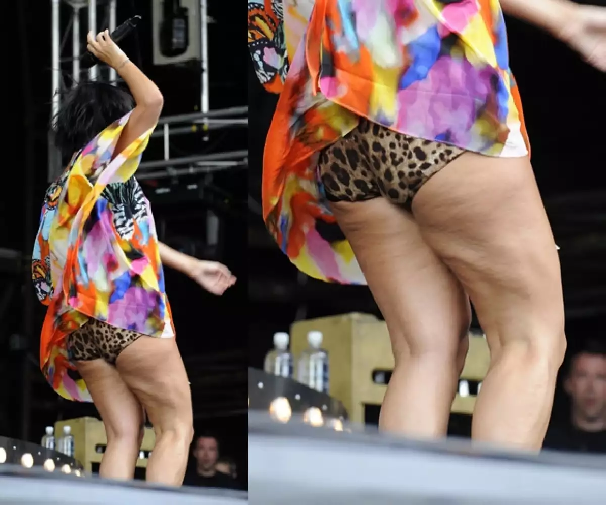 La intérprete de LDN se presentó en un escenario de Australia, ahí los fotógrafos captaron un defecto físico que no sólo la amenaza a ella sino a muchas celebridades.