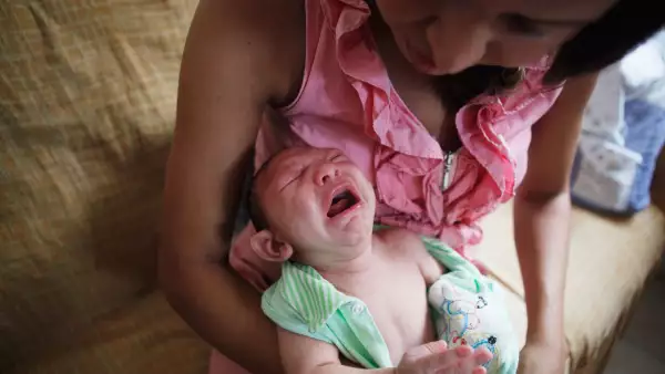 El virus del Zika  también ha sido asociado a enfermedades motrices, como el síndrome de Guillain-Barré, además de microcefalia.