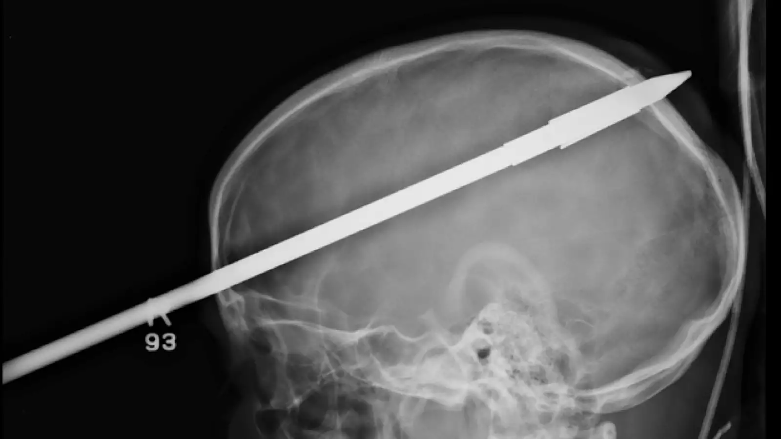 diaparo, lanza, sobrevive