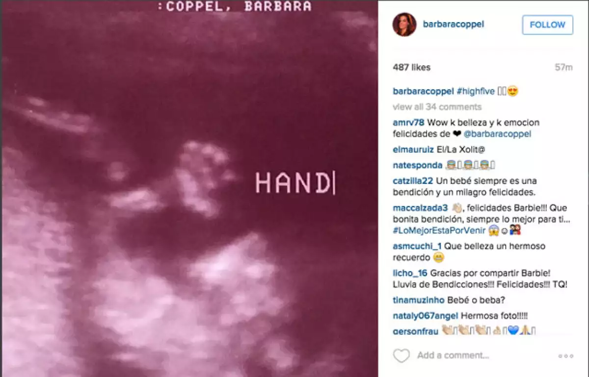 La pareja celebra doble: Su unión matrimonial y la espera de su primer bebé,