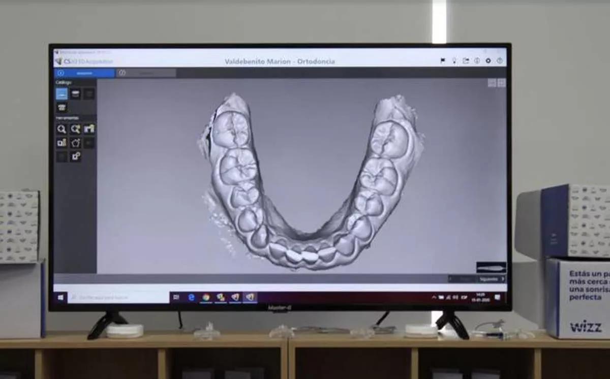 tecnología ortodoncia 