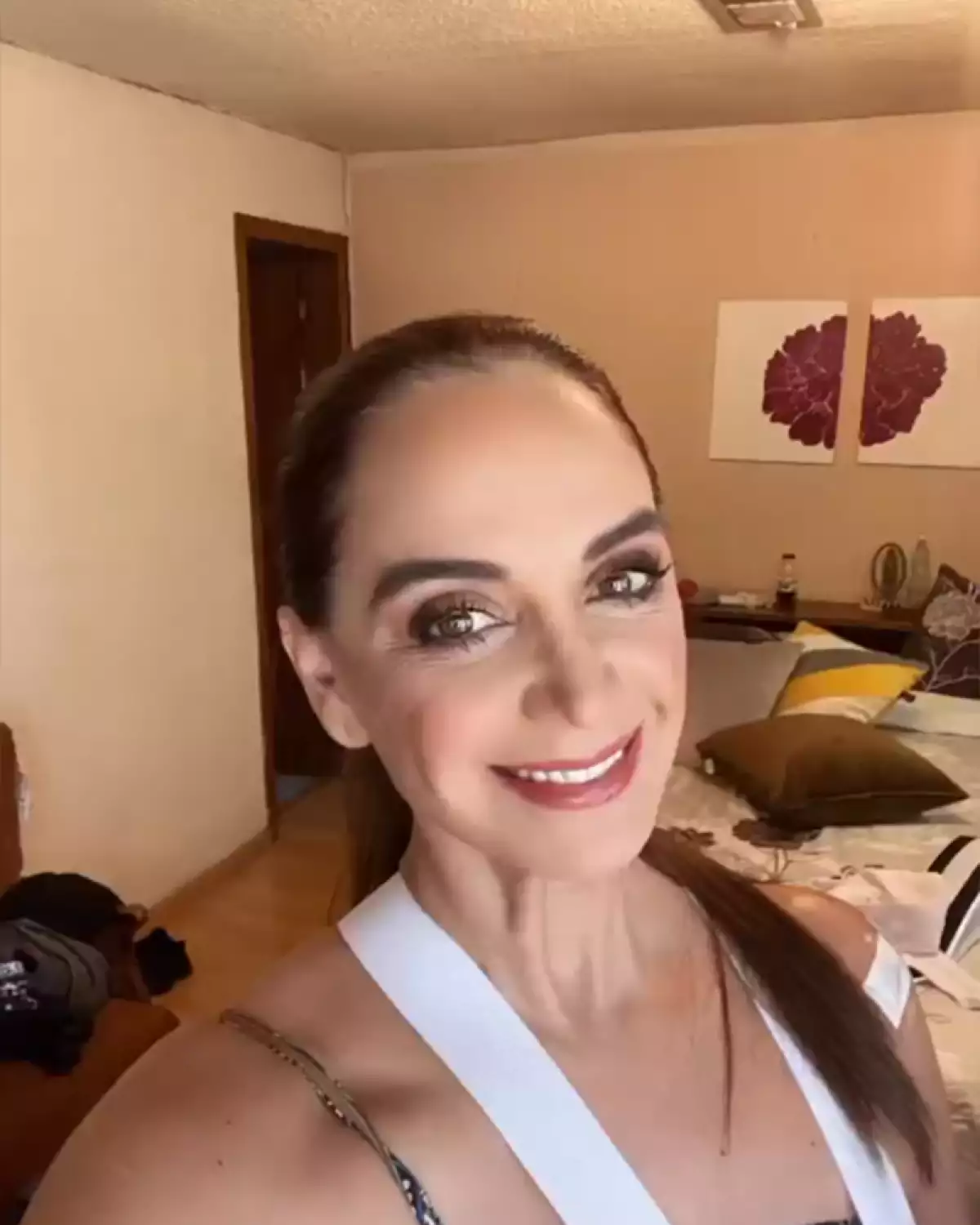 Lupita Jones impacta con operación en el hombro fotos