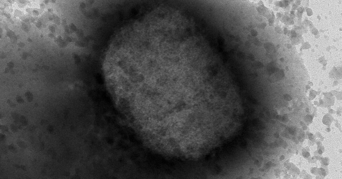 Complete sequence of monkeypox virus obtained Complete sequence of monkeypox virus obtained