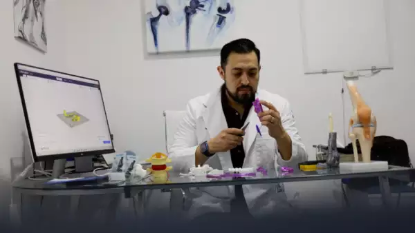 Médico hace prótesis de superhéroes para niños