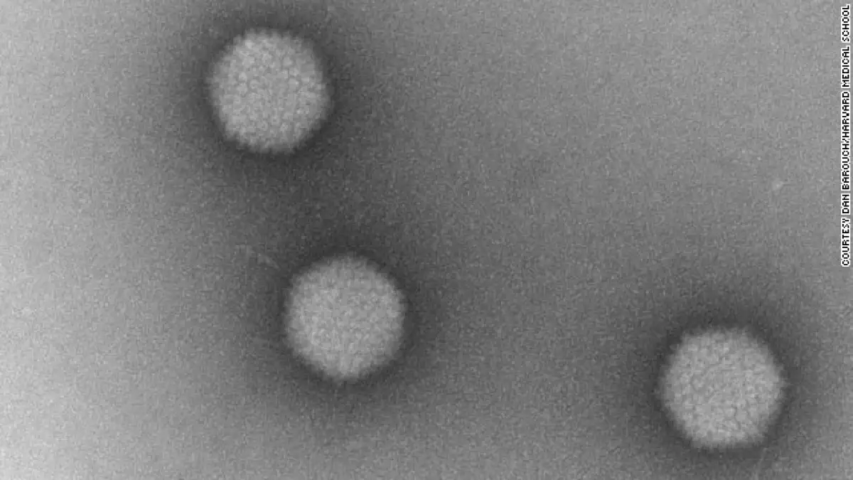 vacuna VIH avance en pruebas monos Harvard