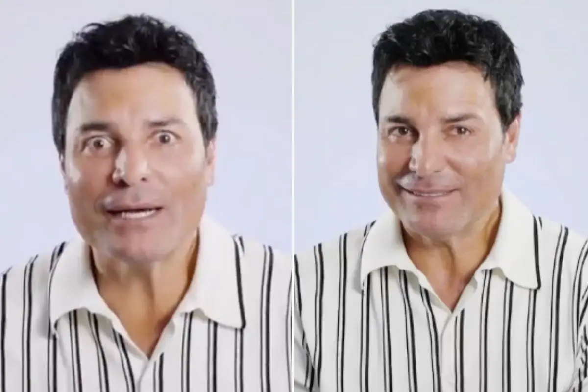 chayanne-botox.jpg