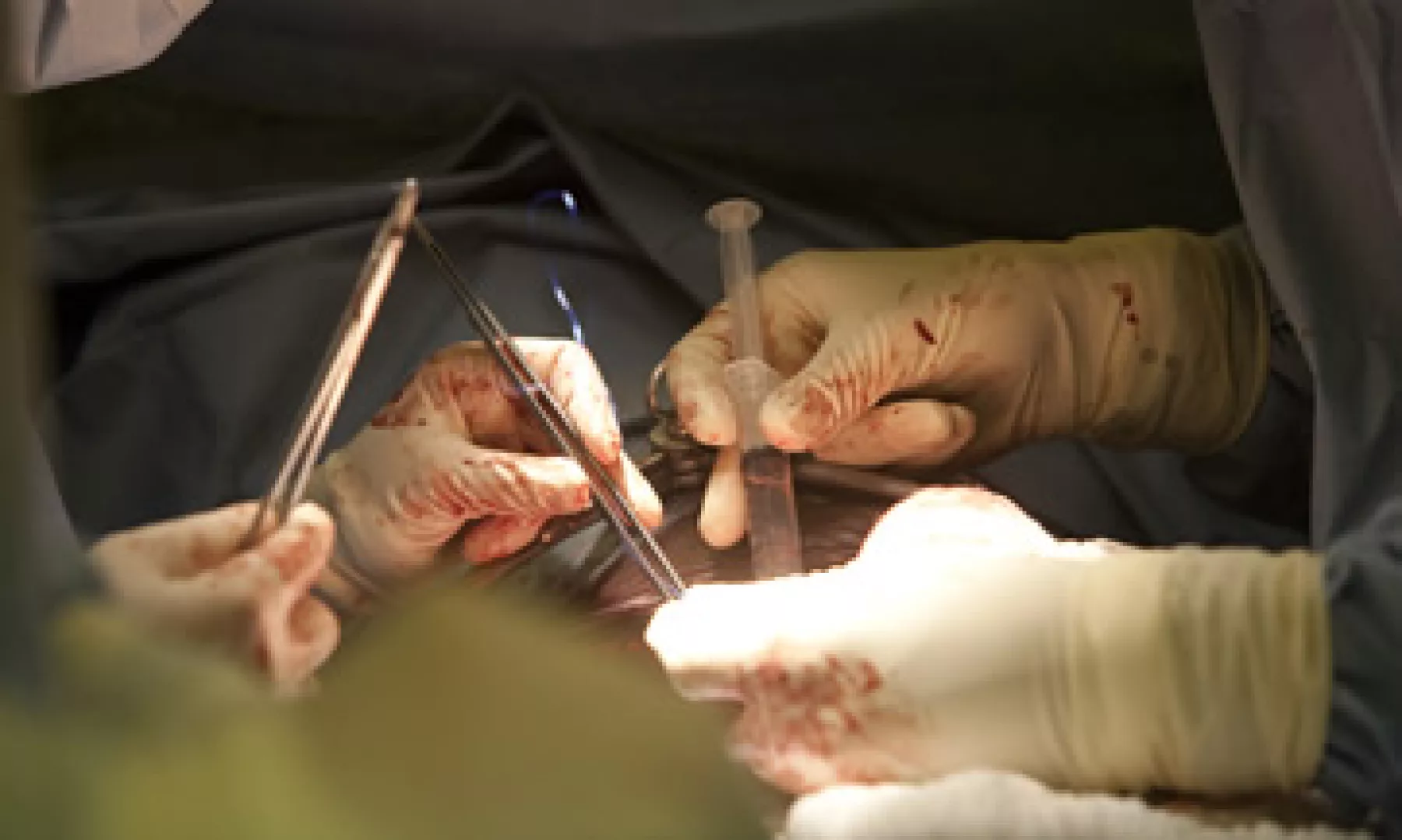 Acuden pacientes que buscan procedimientos de alta complejidad, como la cirugía cardiovascular y los trasplantes. (Foto: Getty Images)