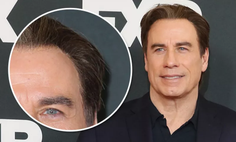 Fue en la gira de prensa de las nuevas series del canal FX, que el actor dejó ver algo inusual en su cabeza. Al parecer, una parte de su pelo estaba pegada a su sien.