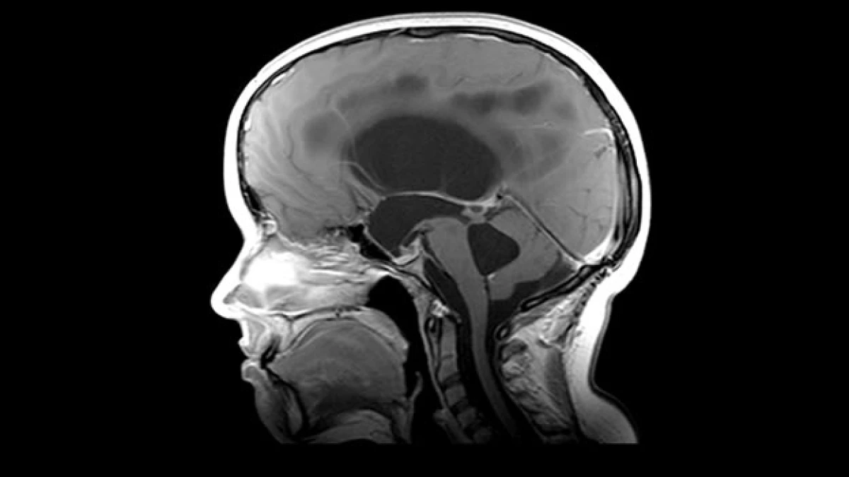brain