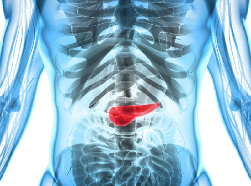 c�ncer de p�ncreas