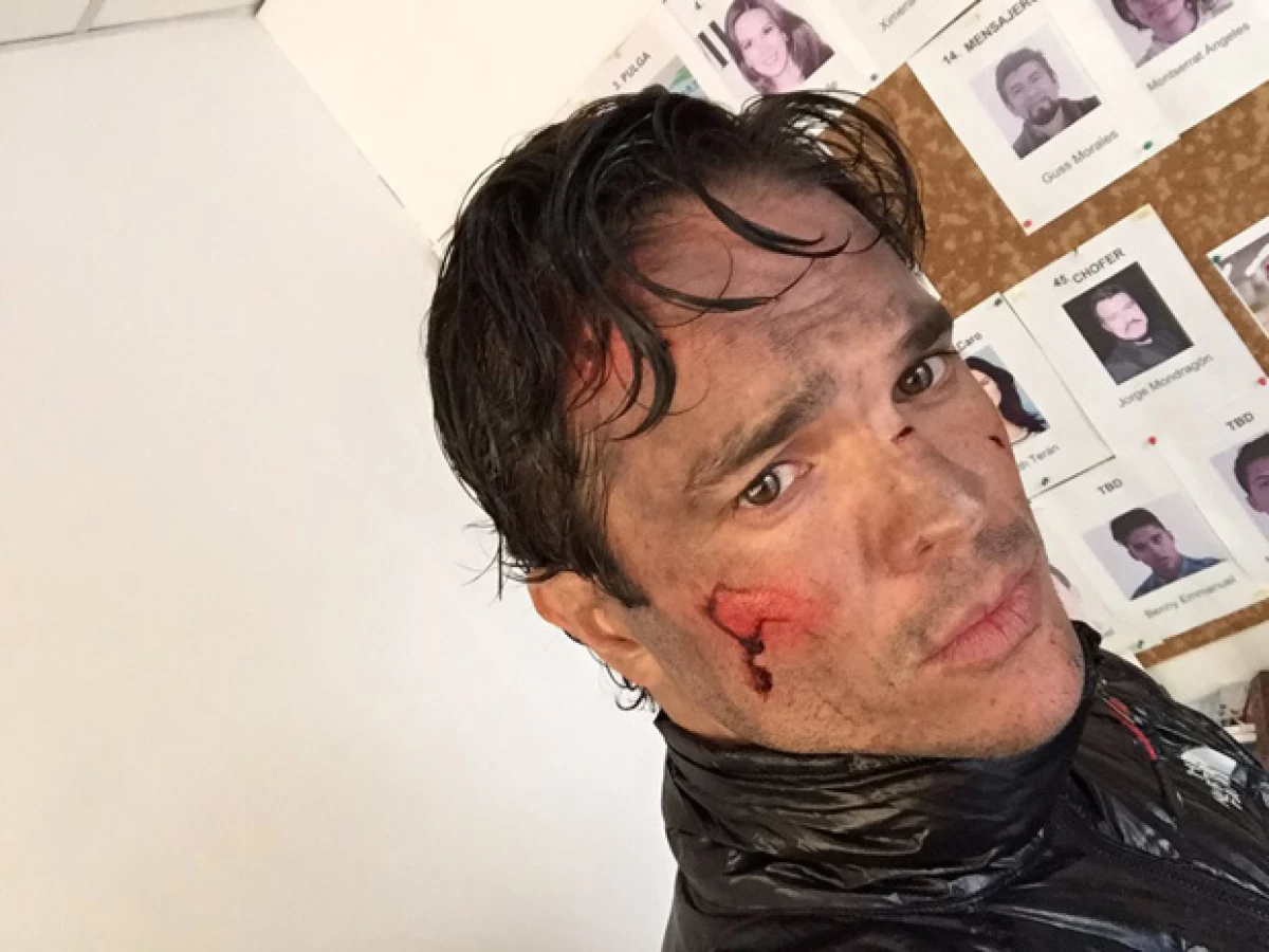 Por culpa de los químicos del maquillaje, el actor ha perdido parte de la visión en uno de sus ojos.