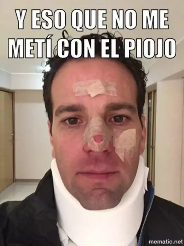 Hace referencia al caso de El Piojo Herrera, a pesar del accidente l periodista no pierde el humor.