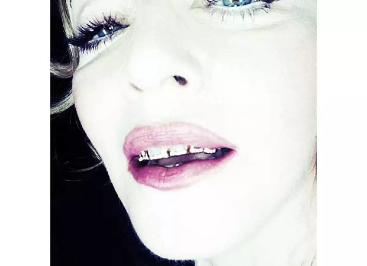 Las parrillas dentales de Madonna son de 24 diamantes.