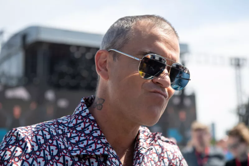 Robbie-Williams-Calvicie