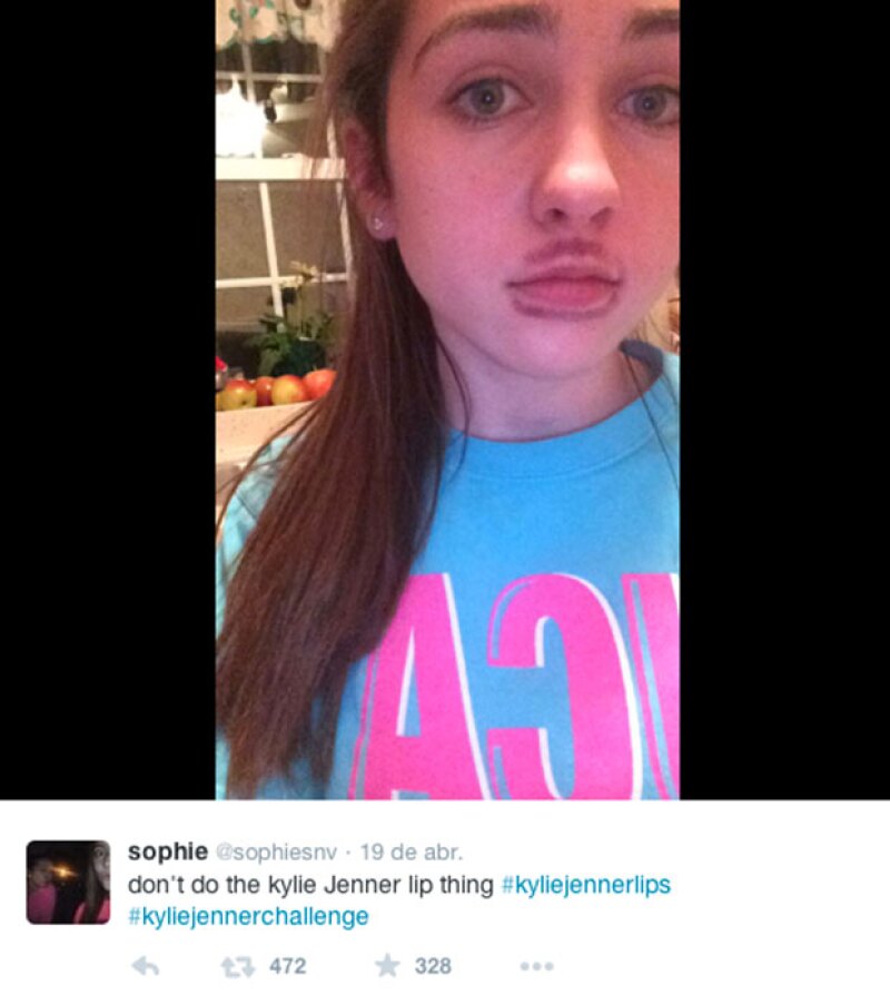 Labios De Kylie Jenner Causan Peligroso Trending Topic