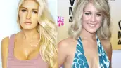 La estrella de The Hills concedió a la revista Life & Style una sesión de fotos donde muestra las marcas de algunas de sus cirugías y confiesa que está arrepentida de habérselas practicado.
