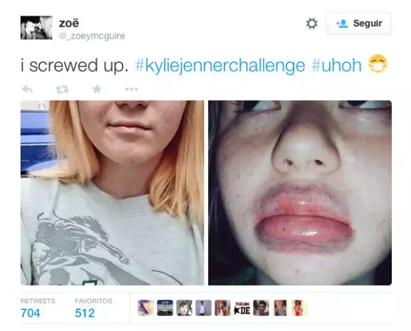 Las consecuencias pueden ser desatrozas.