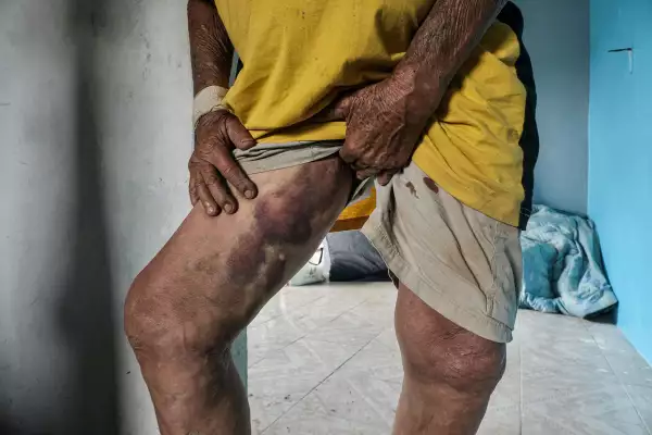 "The grandparents" who embraced each other and were saved in the floods in Mexico MEXICO-CLIMATE-FLOOD-SURVIVORS