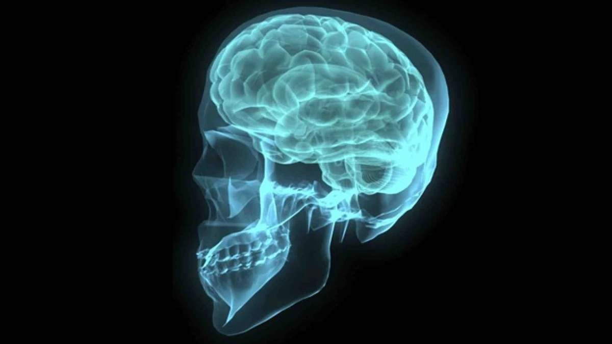 cerebro