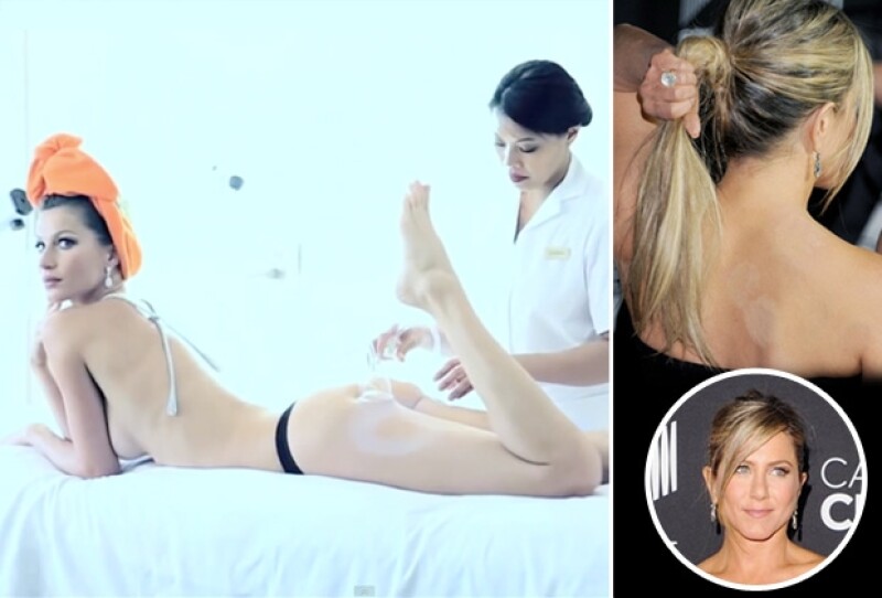 En otra de las secuencias, la esposa de Tom Brady presume cuerpazo mientras recibe un tratamiento de cupping, uno de los favoritos de Jennifer Aniston, y por el que en algunas ocasiones la hemos visto con marcas en la espalda.