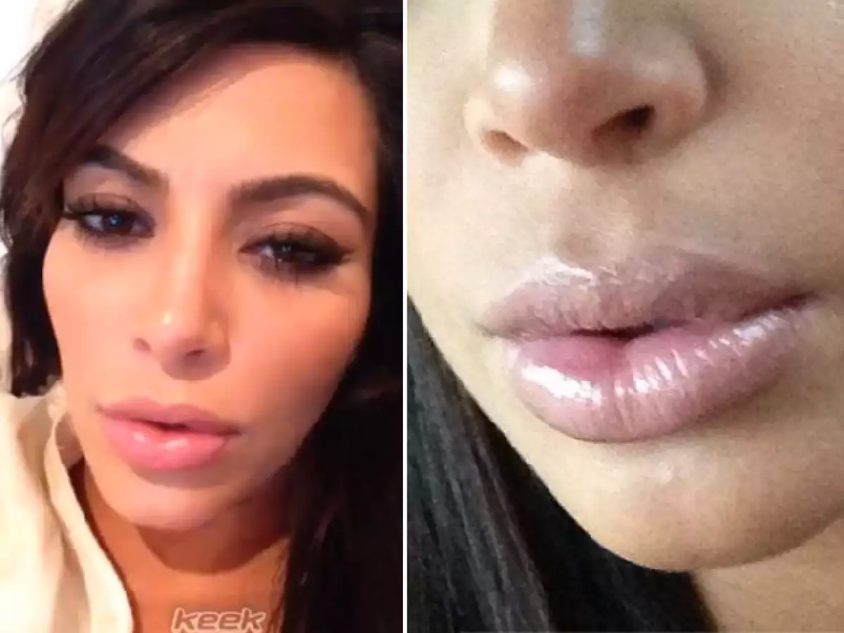 La sociliaté compartió a través de Instagram una fotografía de sus voluminosos labios, los cuales atribuyó a su embarazo.