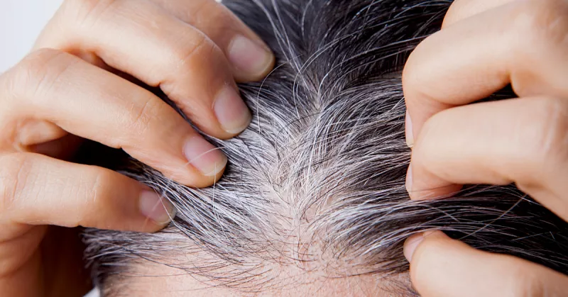 estres-aparicion-canas-.jpg