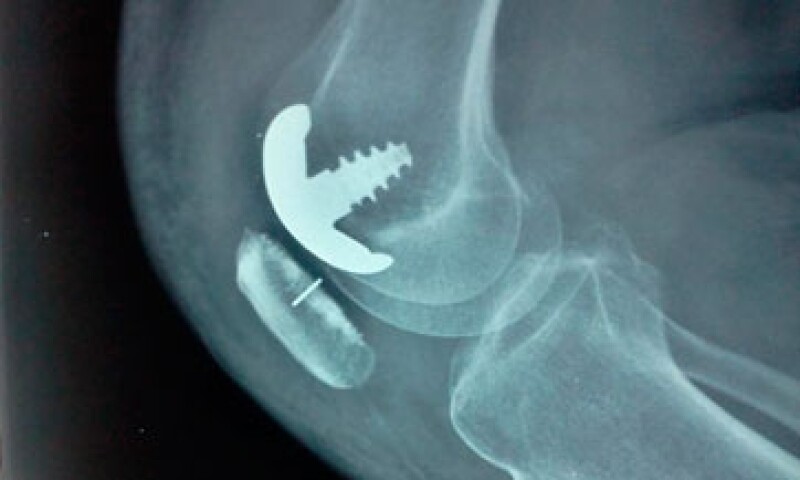 Rodilla