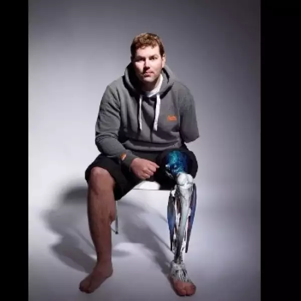 alternative-limb-project-09