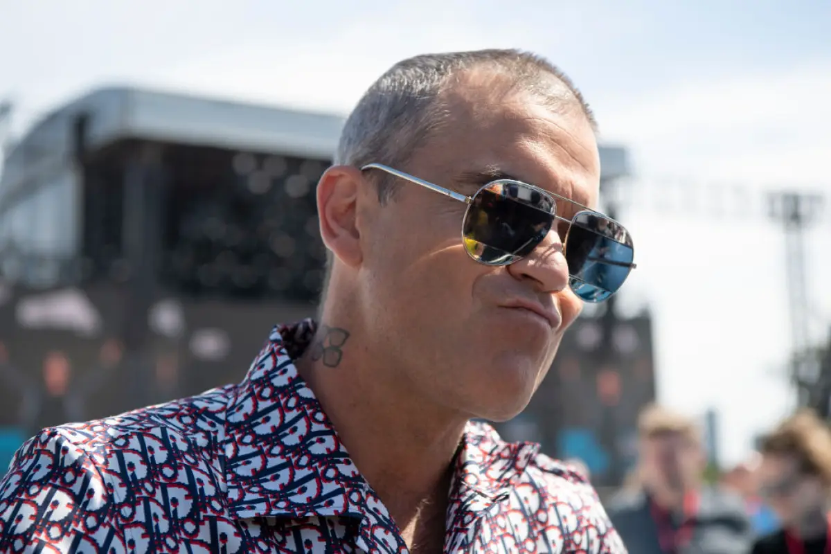 Robbie-Williams-Calvicie