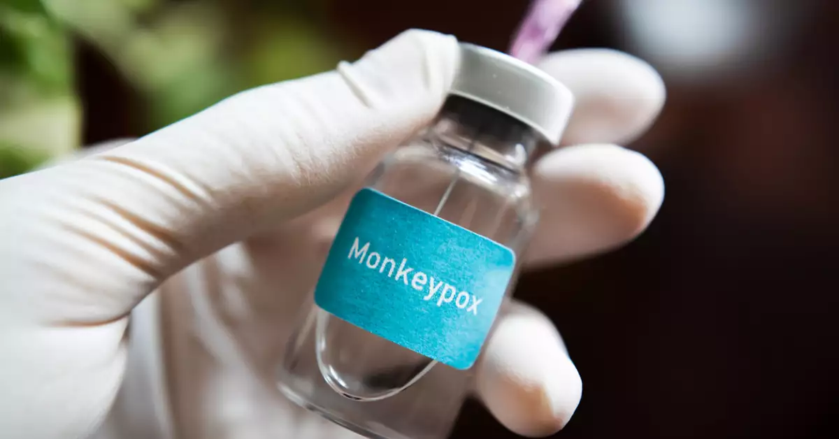 ¿Hay vacunas para enfrentar la viruela del mono (mpox)?