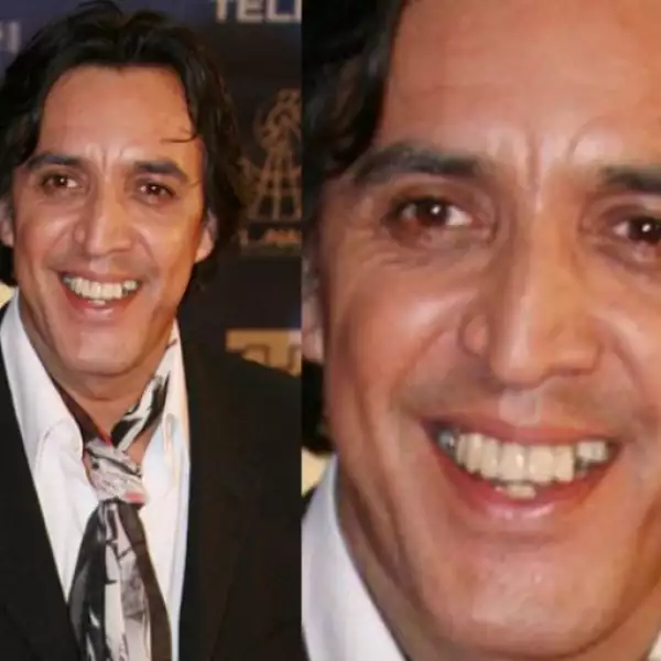 Luis Felipe Tovar sabe que tiene muy mala sonrisa, pues sus dientes están muy mal cuidados, pero no hace nada para remediarlo y cada que puede sonríe.