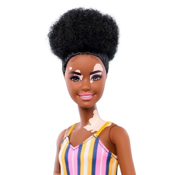Barbie Vitiligo