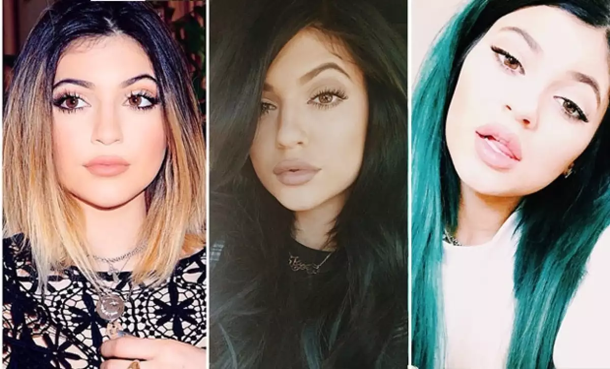 La hermana menor de las Kardashian publicó una foto en su Instagram en la que sus labios lucen más grandes, en entrevistas habló sobre lo que piensa cuando la atacan.