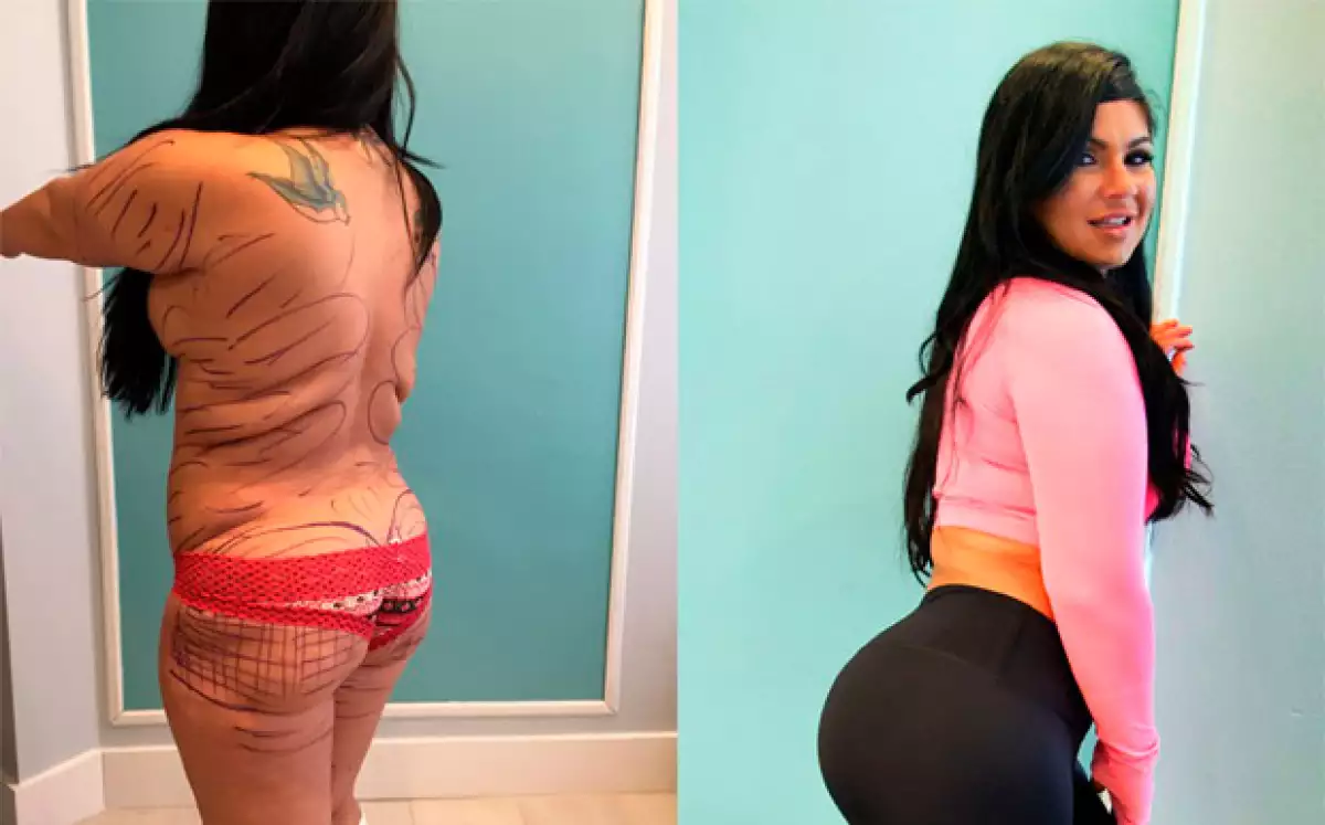 Marlene Chinea, una mujer de 36 años, se sometió a varias cirugías para poder obtener el cuerpo igual al de su modelo a seguir: Kim Kardashian.