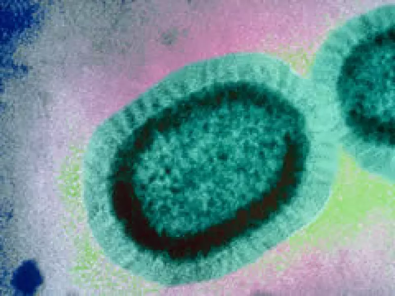 La variante que afecta a México y EU es nueva y está identificada como del tipo A (H1N1), (Foto: Cortesía Laboratorio Sanofi-Aventis y Sanofi-Pasteur)