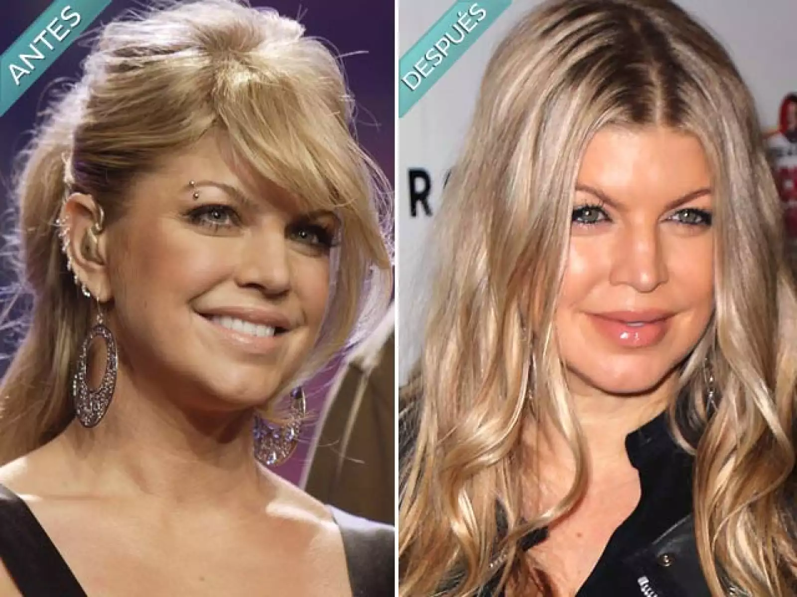 Fergie luce muy guapa, pero lo estaba más antes del levantamiento de cejas y la cirugía para afinar su nariz. Como la mayoría de los famosos el botox le ha deformado sus facciones.