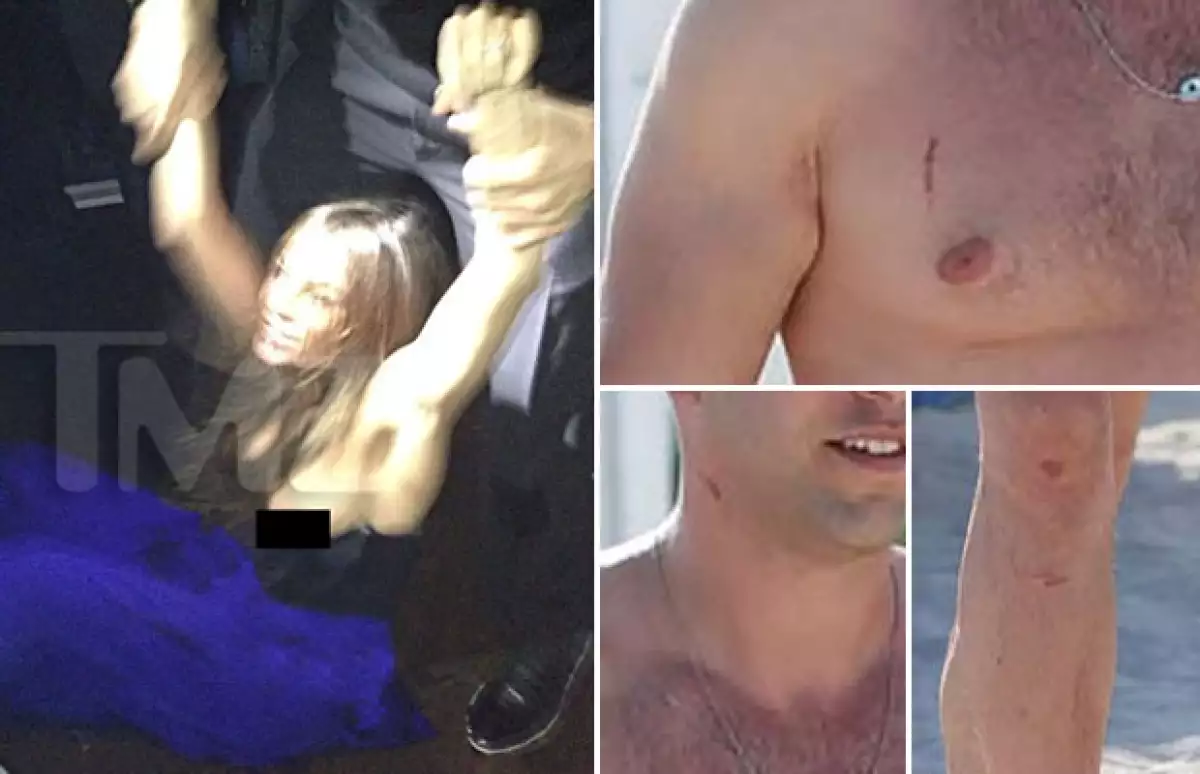 La foto del momento en el que Sofía cae al piso en medio del altercado, y los rasguños de su prometido días después.