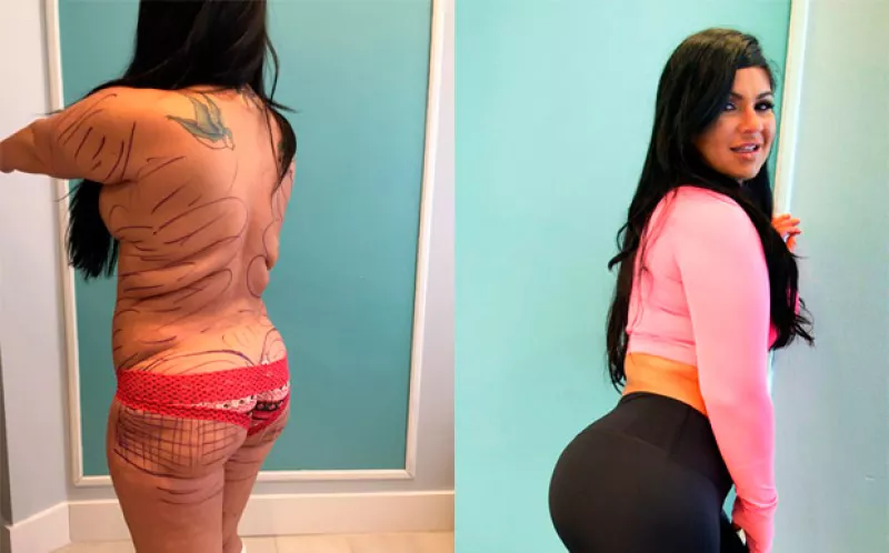 Marlene Chinea, una mujer de 36 años, se sometió a varias cirugías para poder obtener el cuerpo igual al de su modelo a seguir: Kim Kardashian.