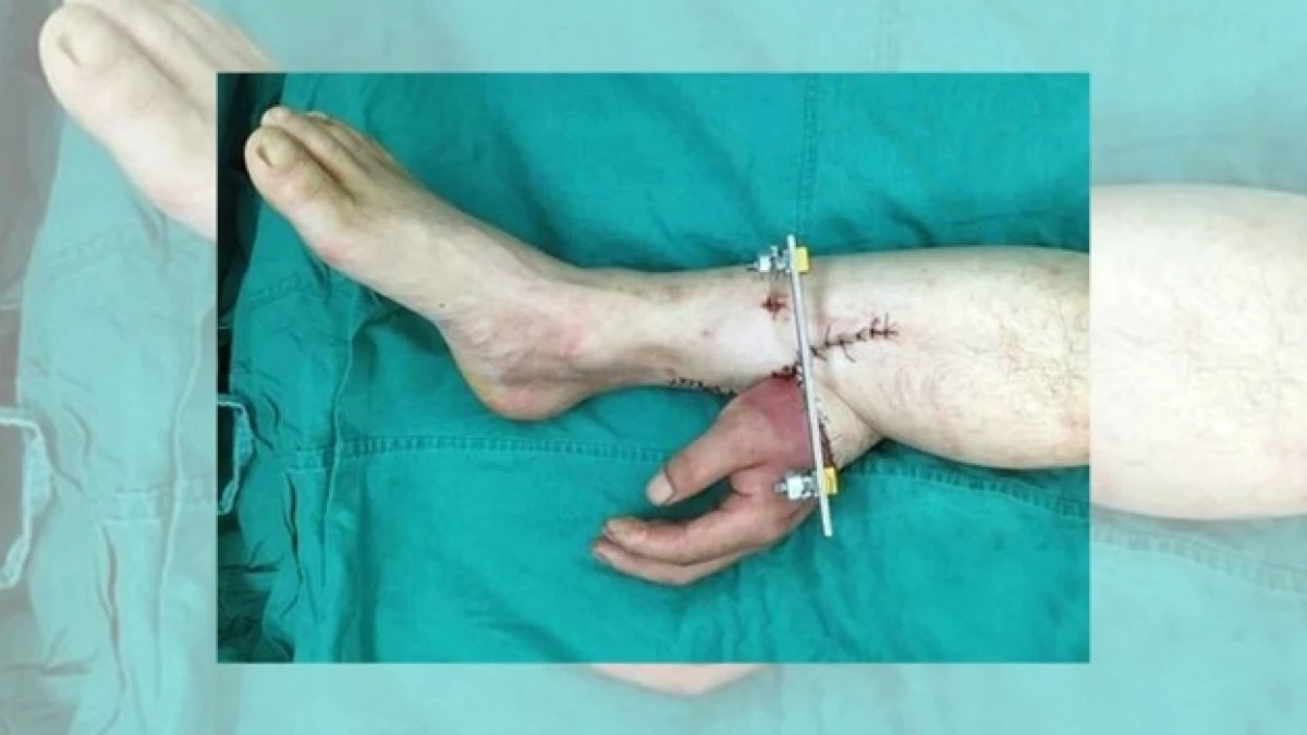 pierna mano