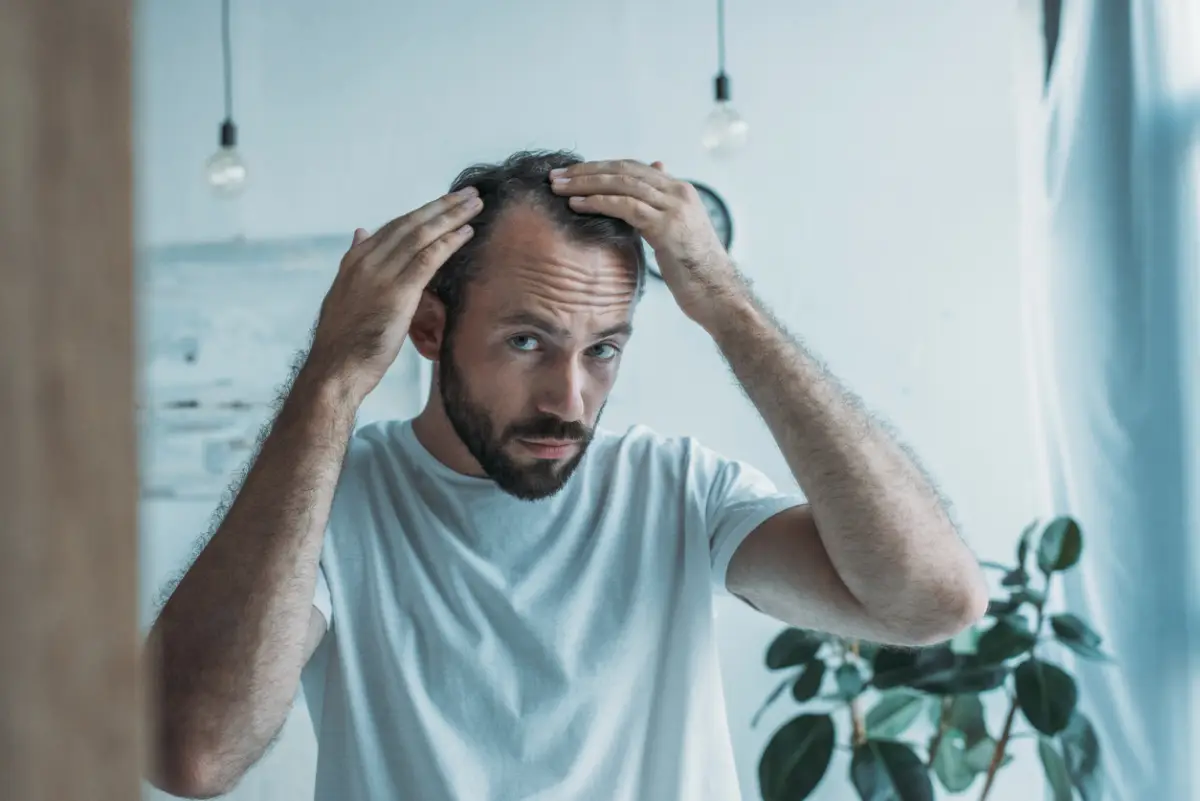 fin-de-calvicie-alopecia-