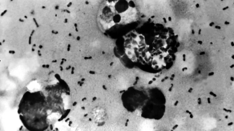 Virus peste plaga bubonica