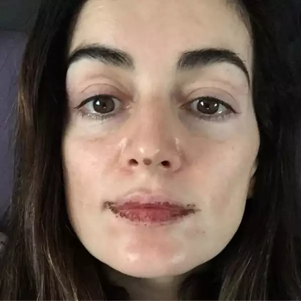 La sinceridad en sus redes sociales la caracteriza, y es que lejos de esconder las cosas que a todos nos pasan, Ana bromea con ellas.