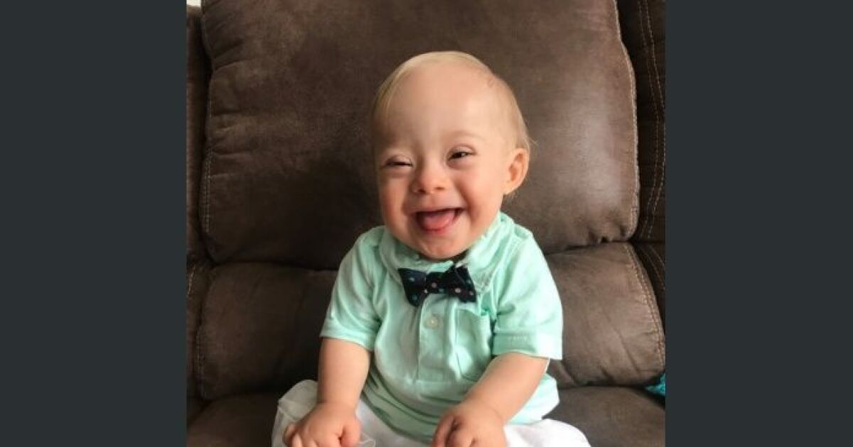 Lucas El Primer Bebe Gerber Con Sindrome De Down