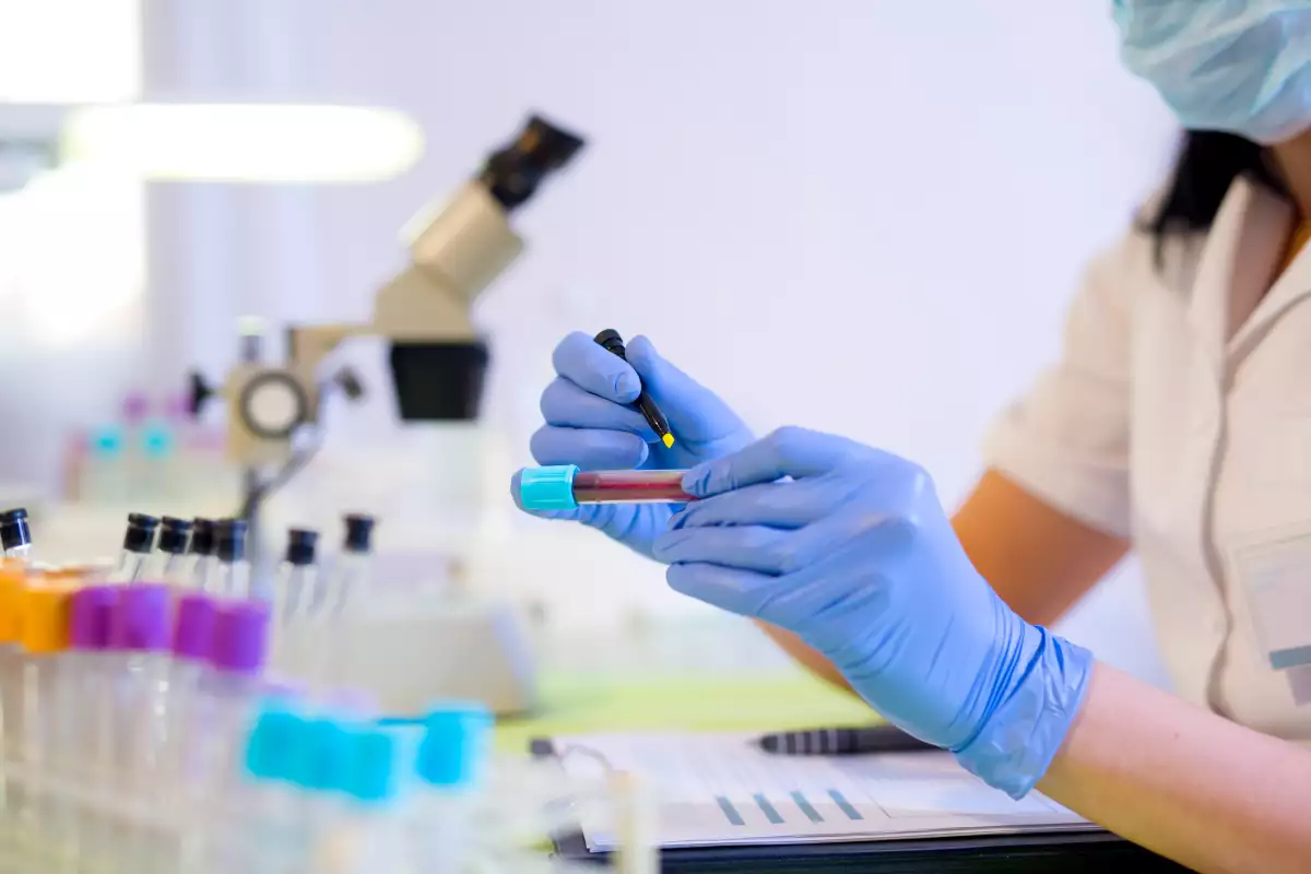 estudios laboratorio