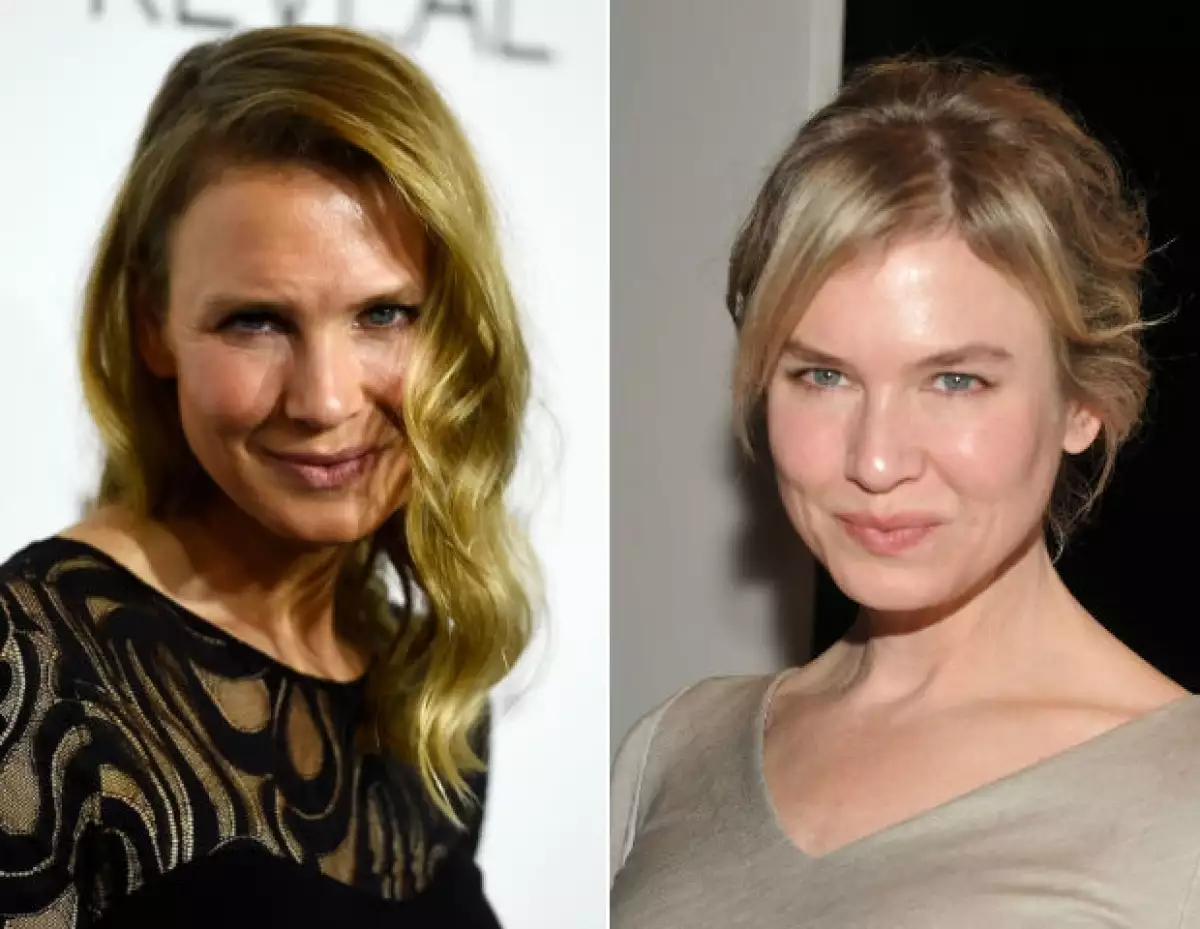 A la derecha, Renée Zellweger en 2011 y a la izquierda se muestra su imagen actual.