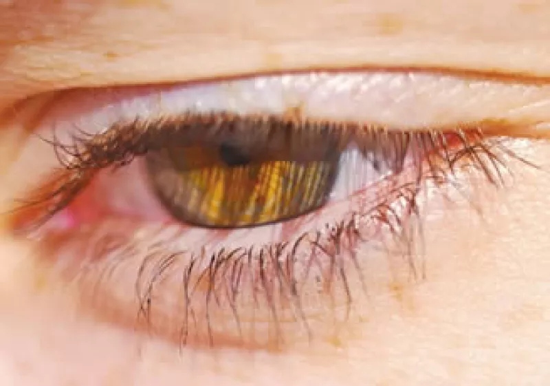 Factores como longevidad, predisposición a enfermedades visuales y menor acceso a servicios de salud hacen a la población femenina más vulnerable. (Foto: Cortesía: SXC)