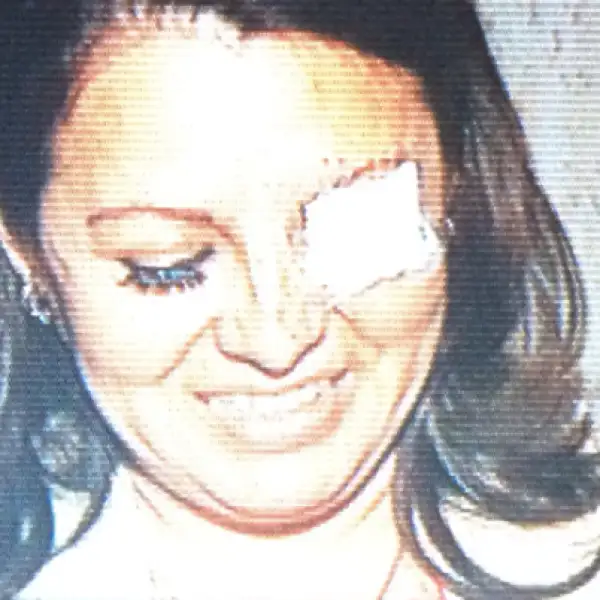 Karen Quiroga, diputada perredista, tuvo un altercado con la diputada Landy Berzunza (en la foto), del PRI, quien tuvo una herida al interior de su ojo tras los arañazos y empujones.