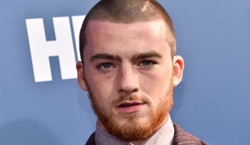 angus-cloud-causa-muerte