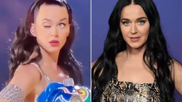 Katy Perry explica la verdad detrás del fallo en su ojo