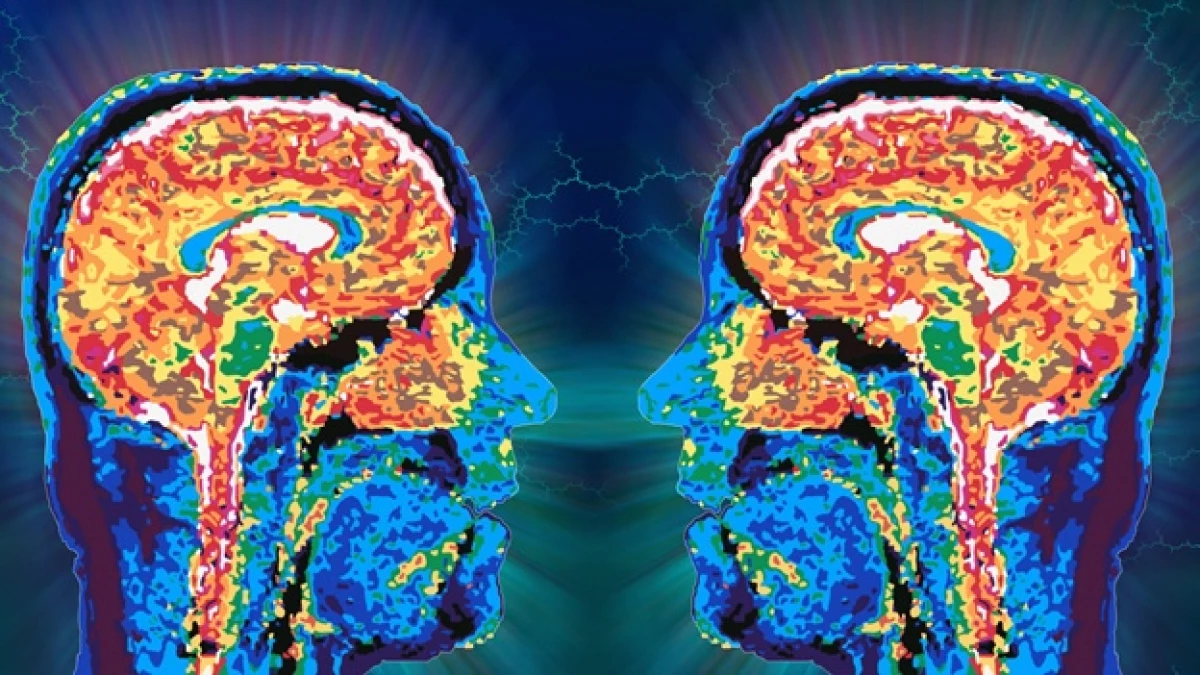 cerebro